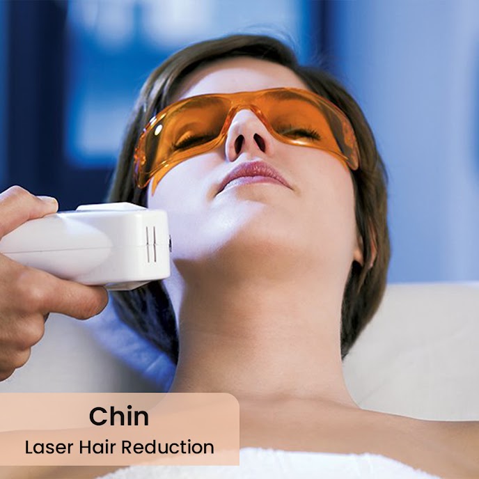 Best Laser Hair Removal Service in Ghaziabad